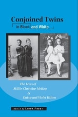cover of Conjoined Twins in Black and White: The Lives of Millie-Christine McKoy and Daisy and Violet Hilton