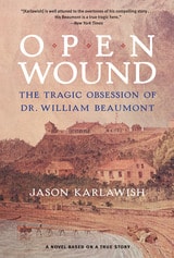 cover of Open Wound: The Tragic Obsession of Dr. William Beaumont