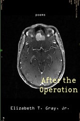 cover of After the Operation
