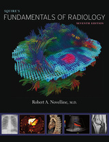 front cover of Squire’s Fundamentals of Radiology