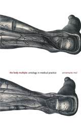 front cover of The Body Multiple